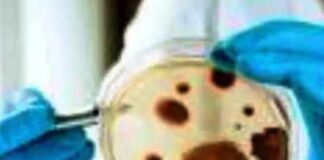 Black fungus cases rise in Andhra Pradesh